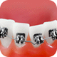 Orthodontic Care